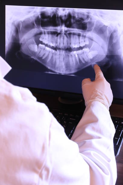 Best Emergency Wisdom Teeth Removal in Spencerville, OH