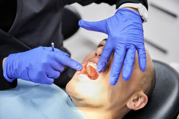 Best Emergency Broken Tooth Repair in Spencerville, OH