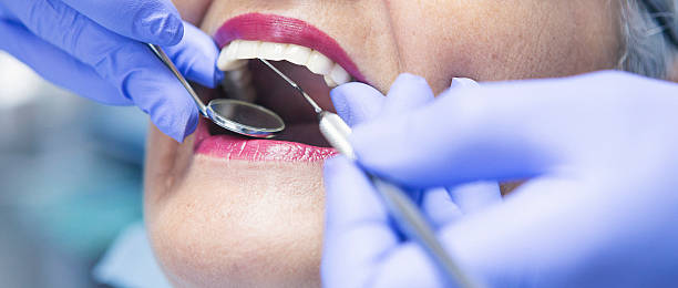 Best Emergency Tooth Extraction in Spencerville, OH